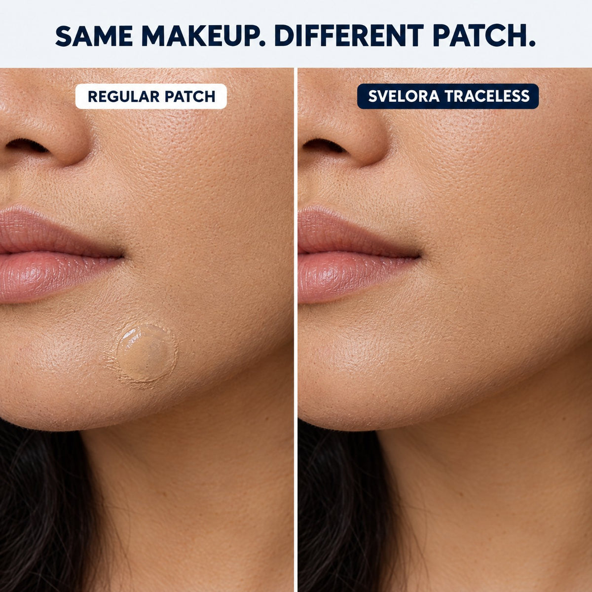 Svelora Traceless Spot Patch